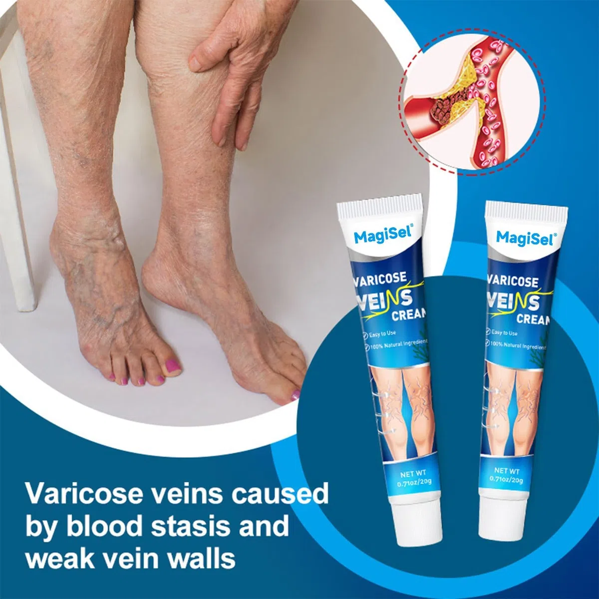 Crema vene varicose, Crema per capillari rotti gambe, Gel Gambe Stanche e Pesanti, Dolore e Circolazione, Riduce Gonfiore, Dolore Capillari Visibili 20g
