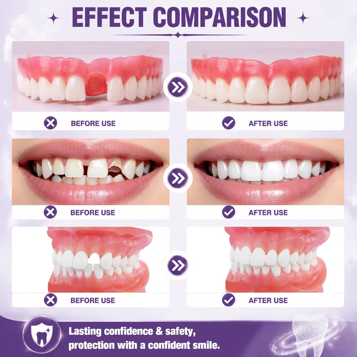 Cemento Dentale Definitivo, Cemento per Denti, Colla per Denti, Adatto per Corone e Protesi Dentali, Il Restauro dei Denti, Resistente Al Calore e Impermeabile
