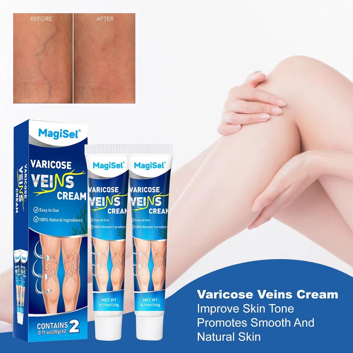 Crema vene varicose, Crema per capillari rotti gambe, Gel Gambe Stanche e Pesanti, Dolore e Circolazione, Riduce Gonfiore, Dolore Capillari Visibili 20g