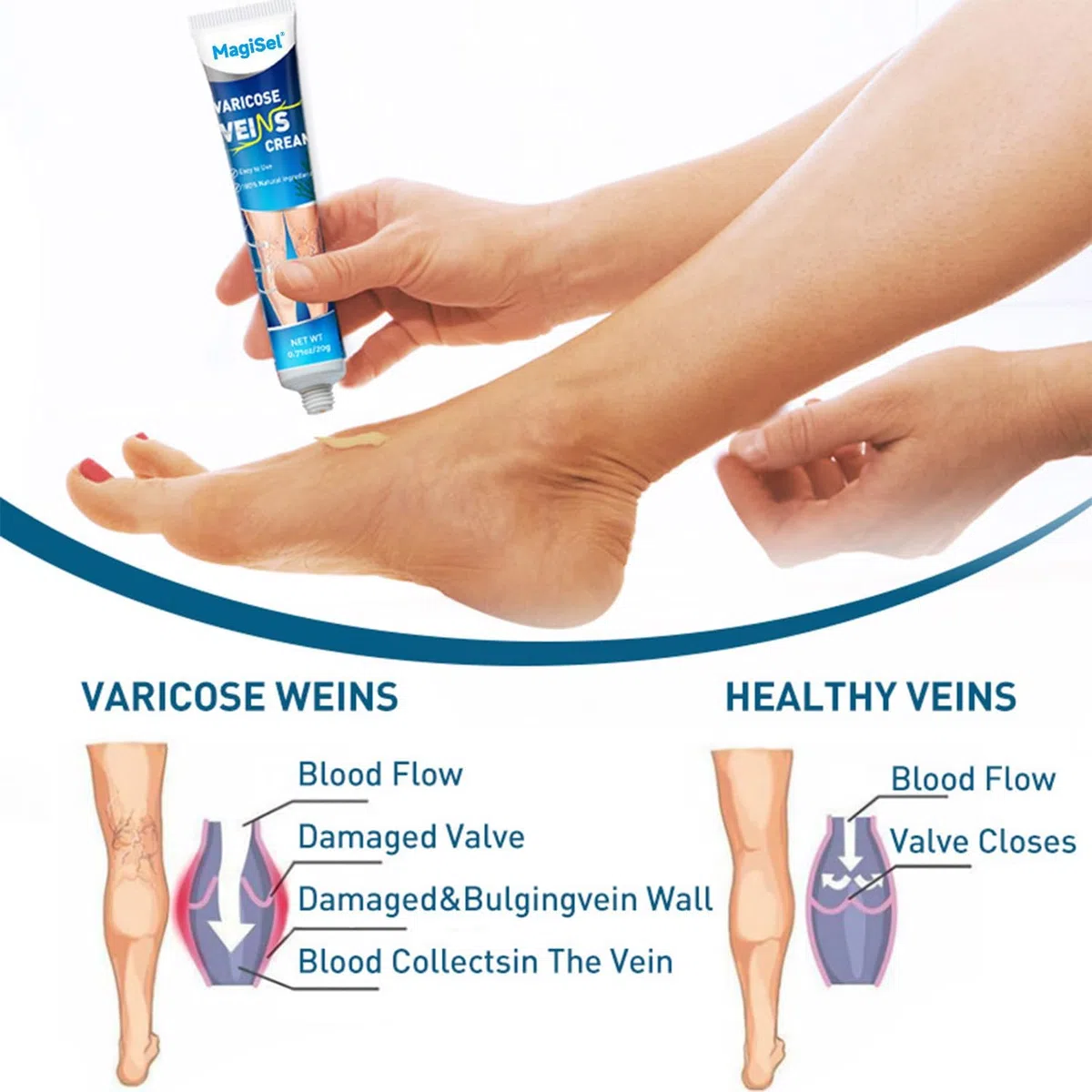 Crema vene varicose, Crema per capillari rotti gambe, Gel Gambe Stanche e Pesanti, Dolore e Circolazione, Riduce Gonfiore, Dolore Capillari Visibili 20g