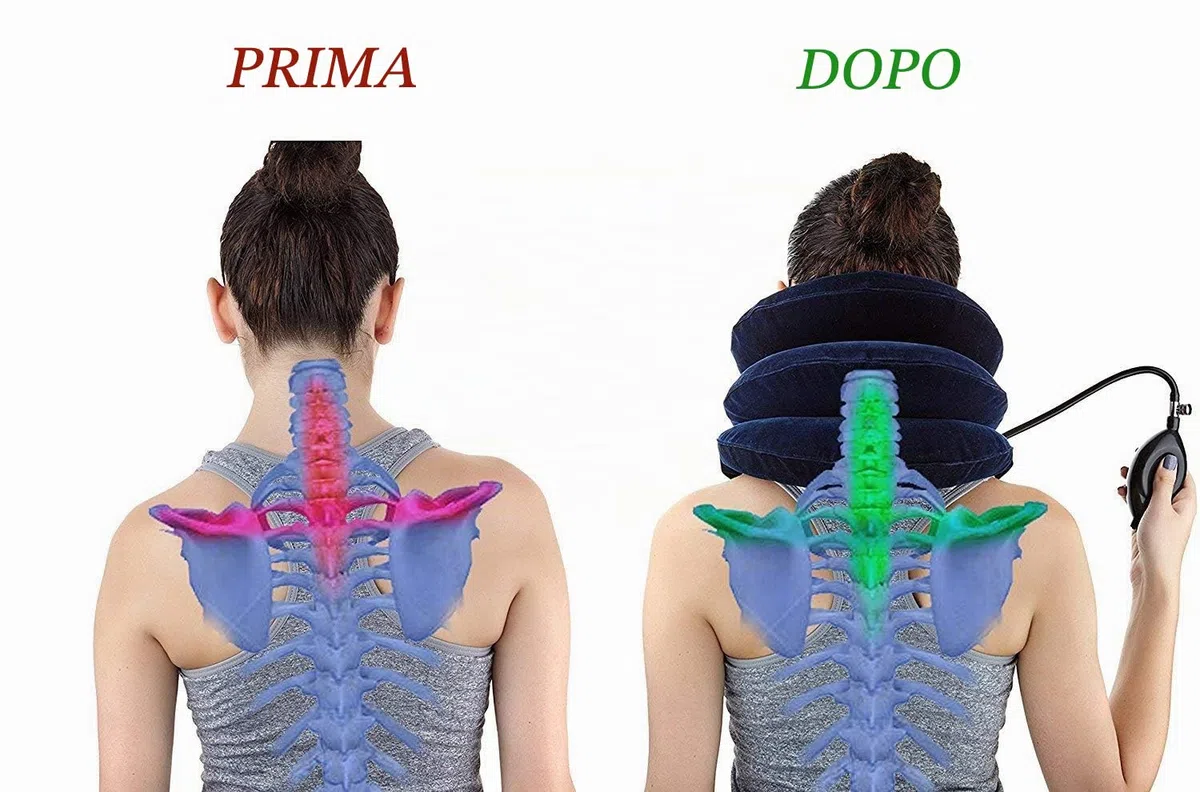 RUNZI Dispositivo di trazione cerviealeper collo e collo gonfiabile, facile da usare per alleviare ildolore cronico al collo e alla spalla,allineamento dellacolomna vertebrale